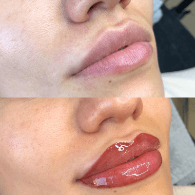 LIP BLUSHING